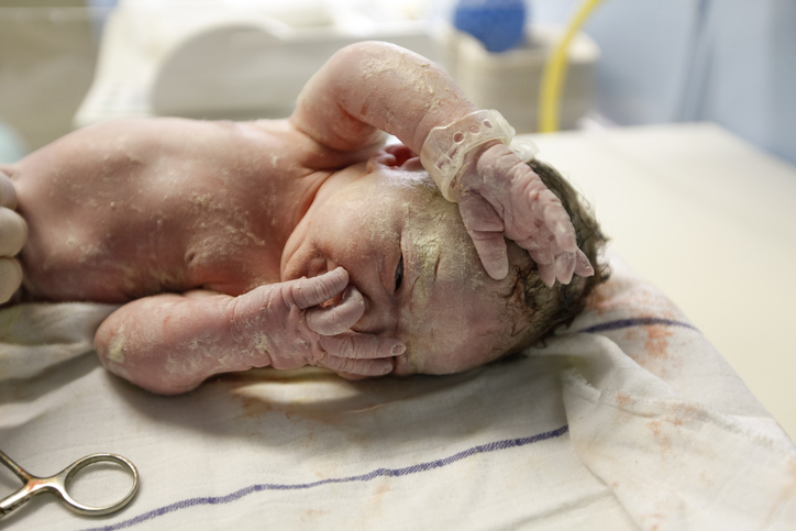Vernix covered newborn with a lot of hair, lying on a table under the light, just after he was born, being assessed for apgar score by a midwife in delivery room in hospital. New life, health assessment concept.